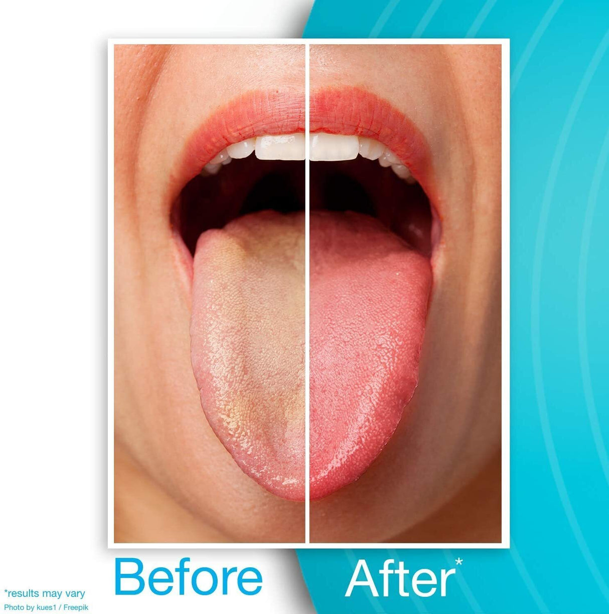 Dr Tung's TONGUE CLEANER Dental Hygiene Stainless Steel Scraper Dr. Tungs