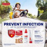 Elastoplast Fabric Extra Flexible Plaster - Pack of 40